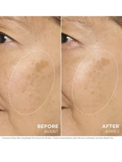 Bright Plus [Advanced] Serum