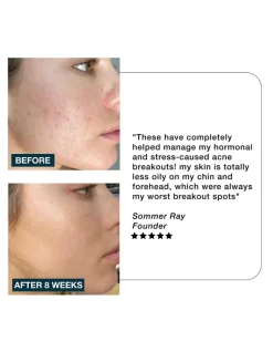 Clarity Anti-Blemish Gummies