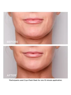 Cryo-Flash Cream-Mask