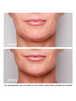 Cryo-Flash Cream-Mask