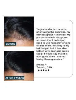 Nourish Haircare Gummies