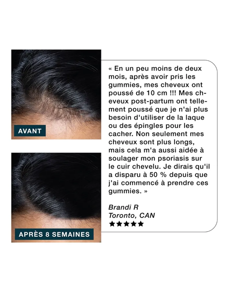 Nourish Haircare Gummies