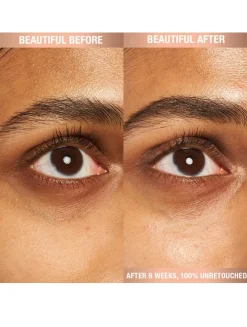 Refillable Magic Eye Rescue Cream with Retinol