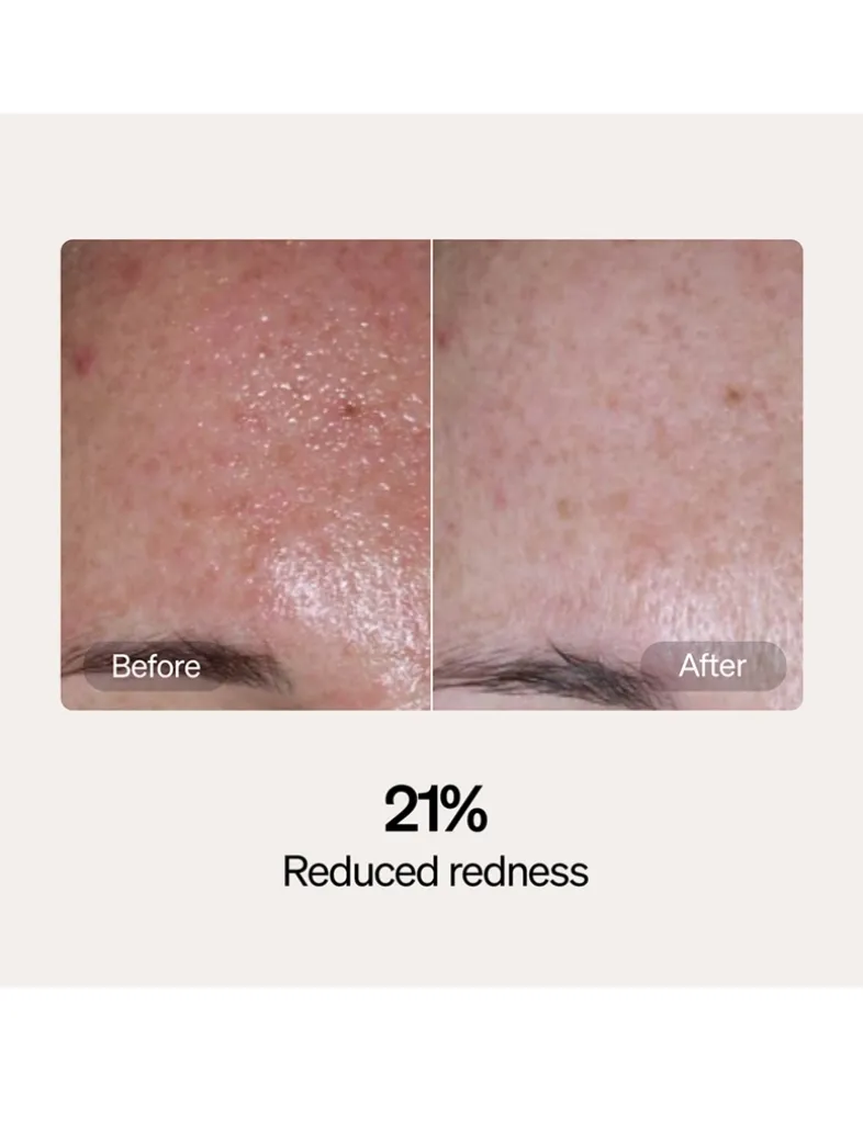 Skincare Serum and Cream Starter Kit